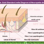 Biopsia Cutanea Neurodiagnostica: Centri Ospedalieri in Italia, Metodi, Marcatori, Valori di Riferimento Diagnostici.