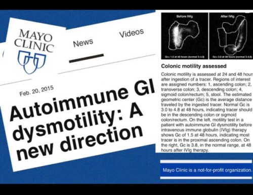 Dismotilità Gastrointestinale Autoimmune: una nuova direzione, dal 2015. Trattabile con IVIG.